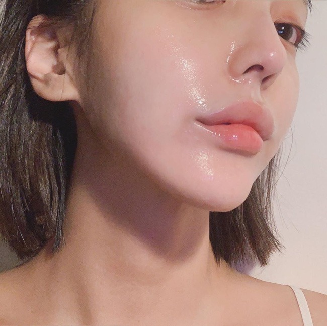 Địa chỉ tiêm HA căng bóng trẻ hóa làn da