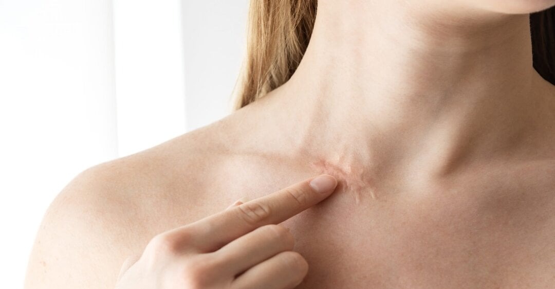 Viện thẩm mỹ điều trị sẹo lồi uy tín