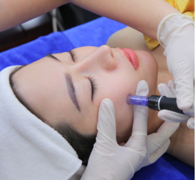 Phi kim trị thâm nám