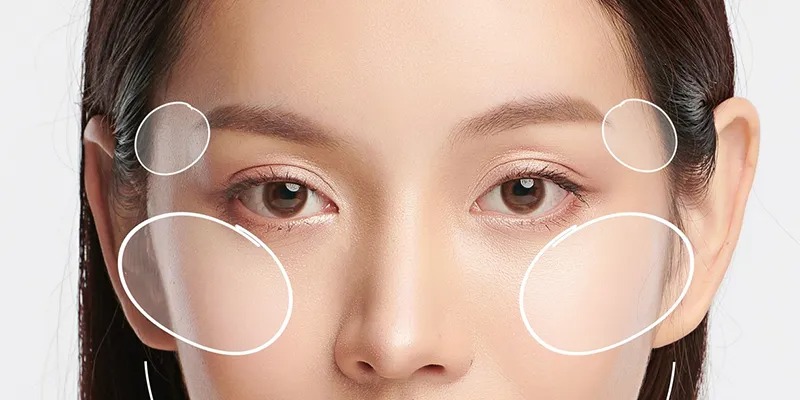 Làm đầy thái dương tự nhiên cùng viện thẩm mỹ KW Clinic