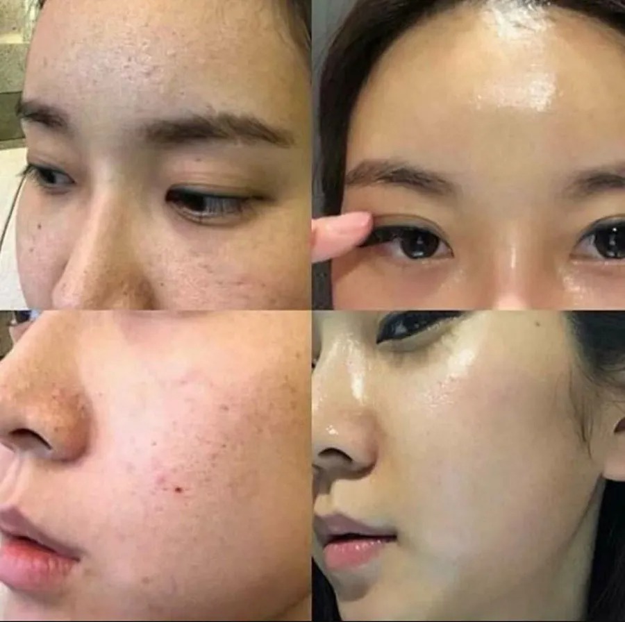 Địa chỉ peel da uy tín