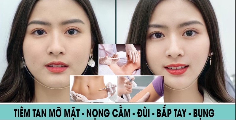 Dịch vụ tiêm tan mỡ